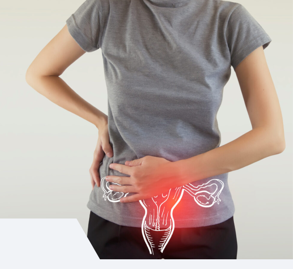 Tratamento para alterações menstruais em Uberlândia