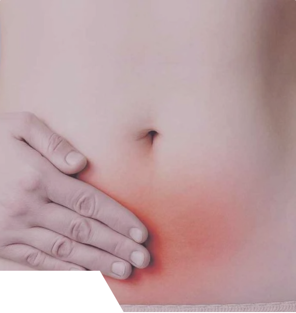 Diagnóstico e tratamento da endometriose
