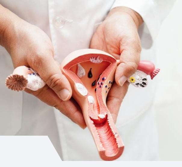 Exame ginecológico preventivo em Uberlândia