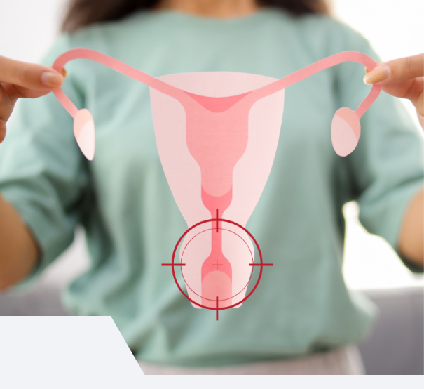 Tratamento de vulvovaginite recorrente em Uberlândia